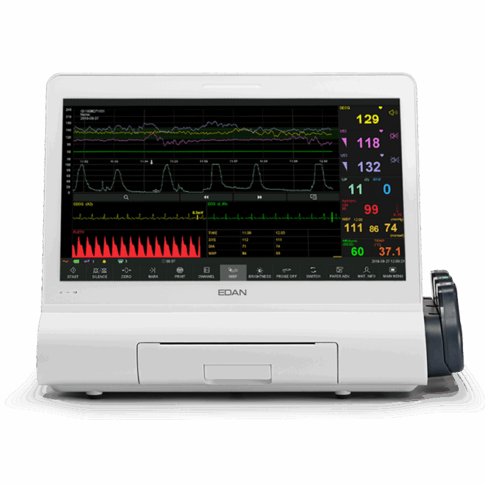 Serie F15 Monitor Materno Fetal